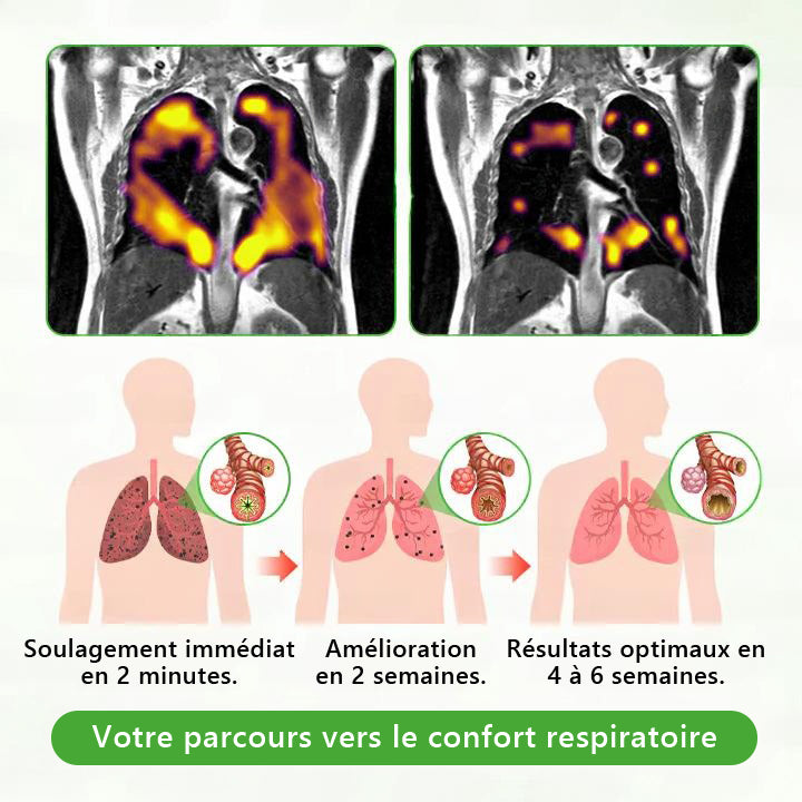 Diffuseur 𝑴𝒖𝑟𝑤𝗈𝗇® à base de plantes Mullein pour le nettoyage des poumons (🫁 Toux, pharyngite, essoufflement, expectorations, nez bouché, bronchite, symptômes allergiques, inconfort pulmonaire)🌐